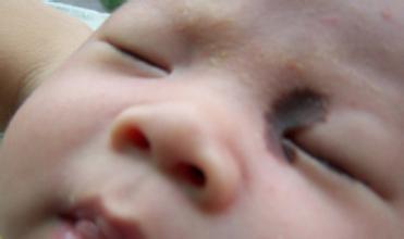 上海哪家医院看咖啡斑比较好