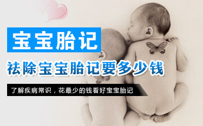 江苏激光治疗胎记的医院