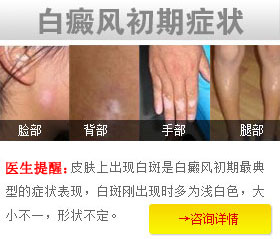 白癜风的早期症状表现