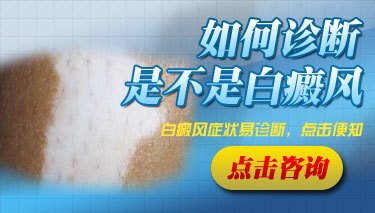 根据白斑来判断白癜风病情