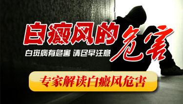 白癜风对人体有哪些影响