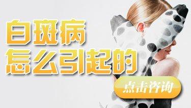 白癜风的患病原因主要有哪些