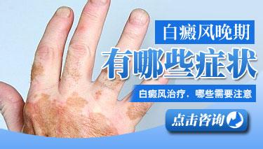 白癜风的有什么明显症状表现