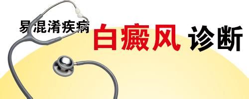白癜风如何辨别