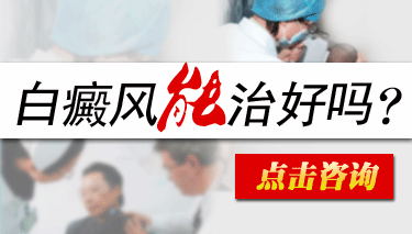 白癜风西医治疗有什么方法
