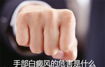 左手白癜风怎么判断