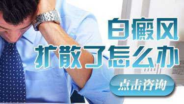 怎么预防泛发型白癜风