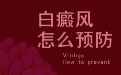 预防儿童白癜风应该怎样做