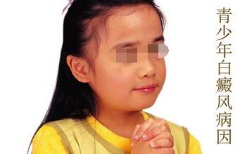几种诱发青少年白癜风的病因我们要了解