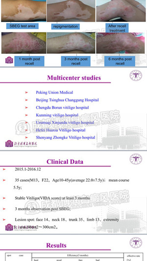 刘志飞教授作学术报告