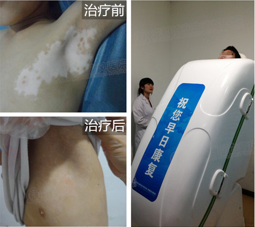 中药熏蒸诊疗图