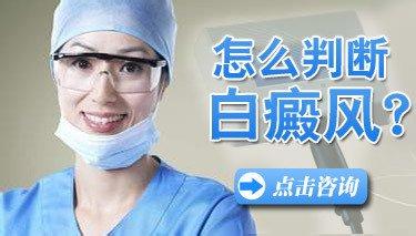 白癜风的检查有哪些特征