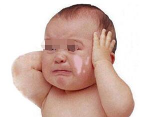 白癜风给孩子带来了什么影响