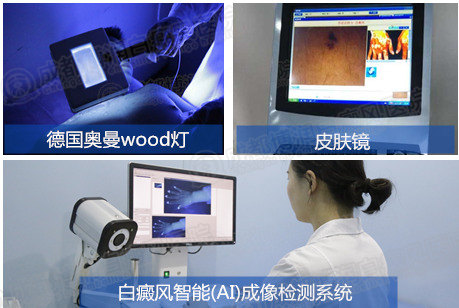 白癜风专业确诊仪器