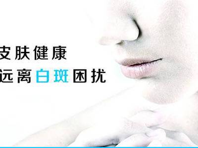 成都哪里治疗白癜风比较好?白癜风不能吃些什么