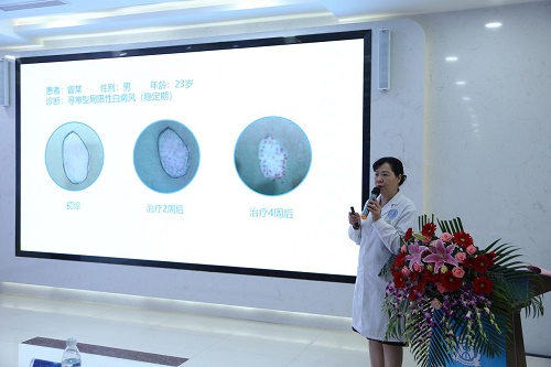 加强临床科研,引领白癜风临床诊疗新思路-成都博润召开“药线点灸治疗白癜风科研课题”启动会